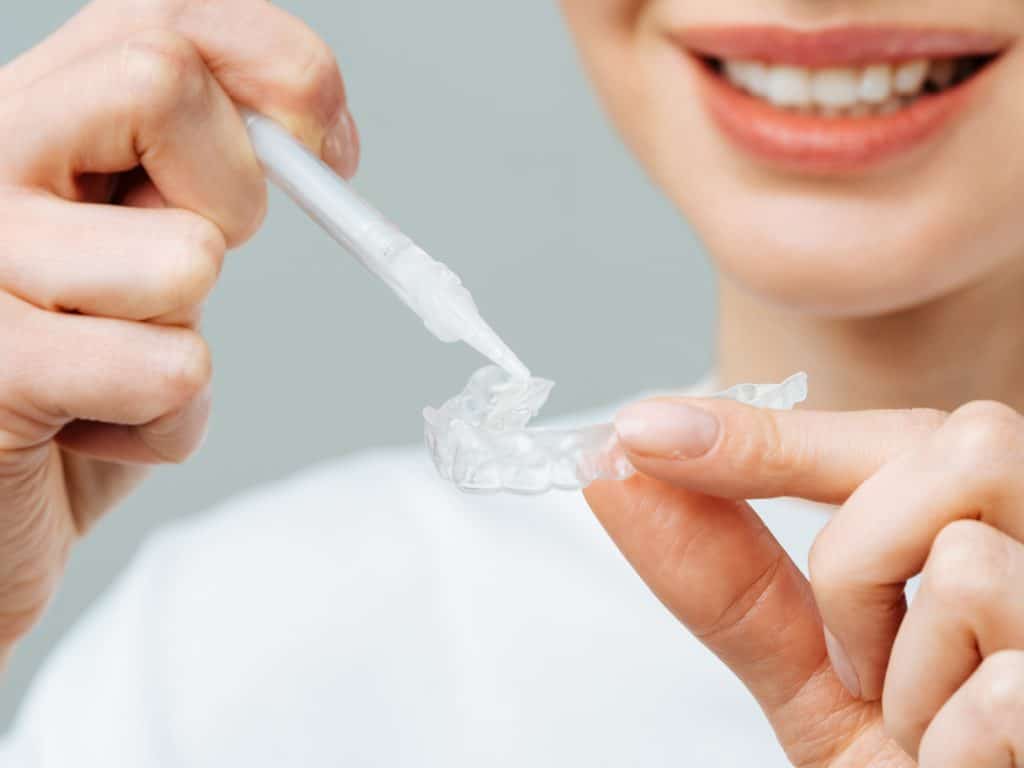 Girl doing home teeth bleaching