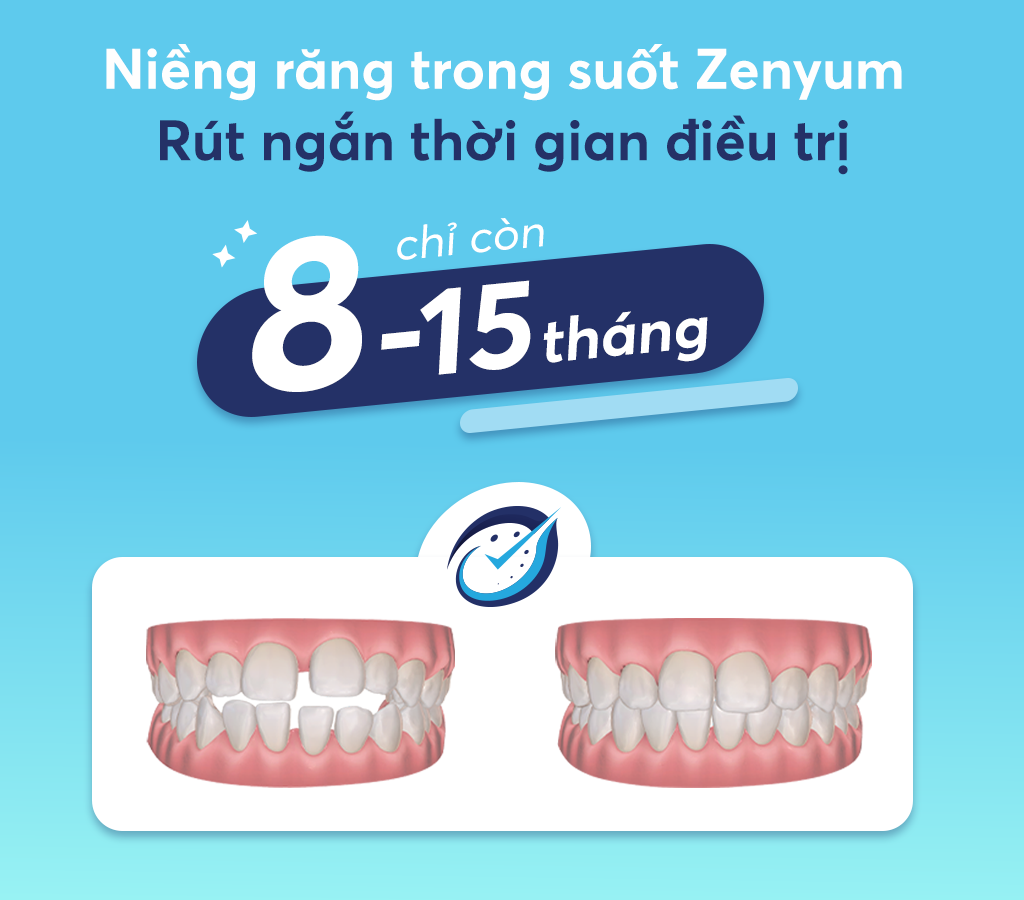 Zenyum rút ngắn thời gian điều trị