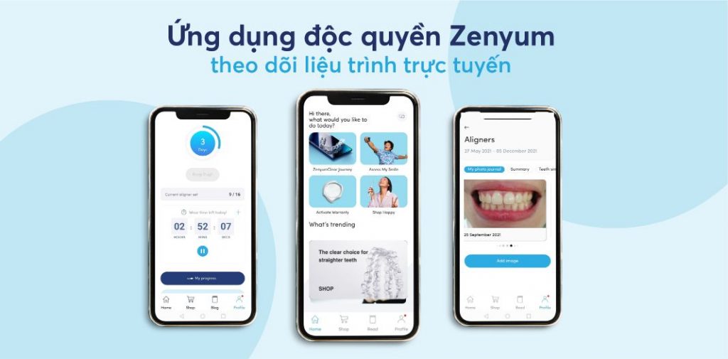 ứng dụng độc quyền Zenyum