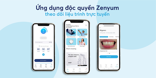 Ứng dụng độc quyền Zenyum giúp theo dõi tiến độ dễ dàng, bạn luôn được hỗ trợ mọi lúc và không cần đến gặp nha sĩ nhiều lần