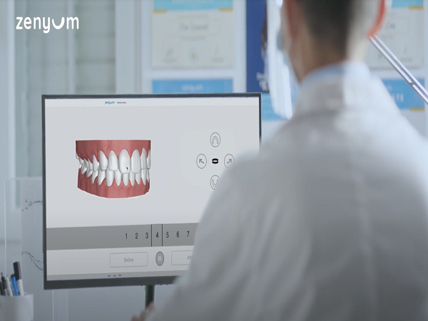 Yếu tố ảnh hưởng đến chi phí niềng răng