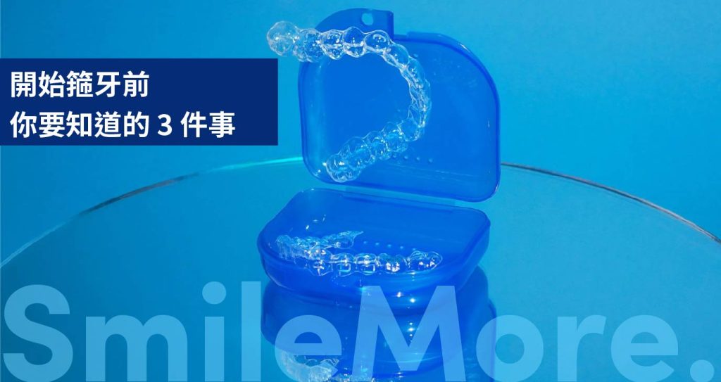 開始箍牙前你要知道的3件事