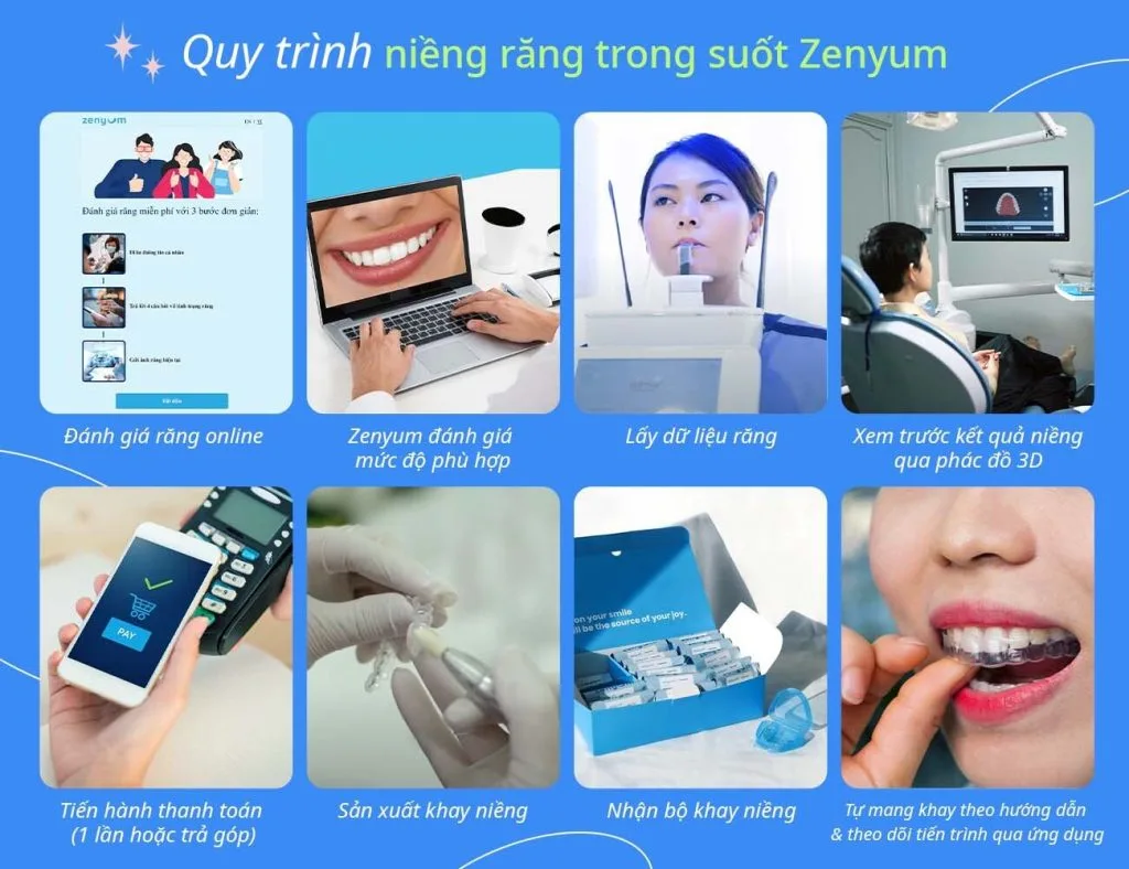 Quy trình niềng răng trong suốt