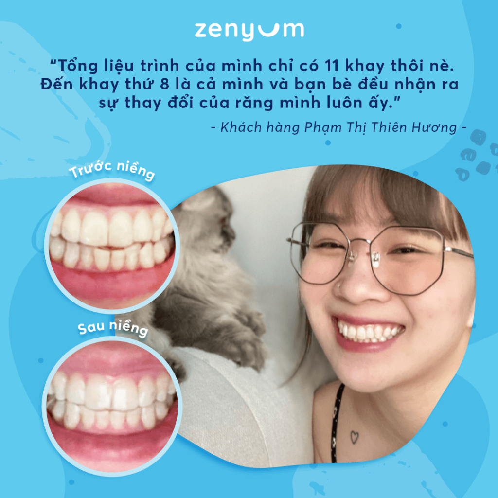 hình ảnh điều trị lệch khớp cắn với niềng răng trong suốt Zenyum