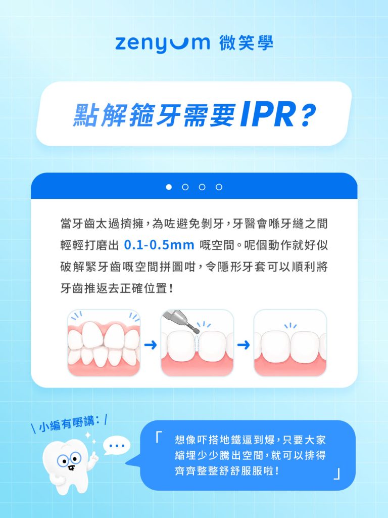 為甚麼箍牙前需要 IPR 磨牙?