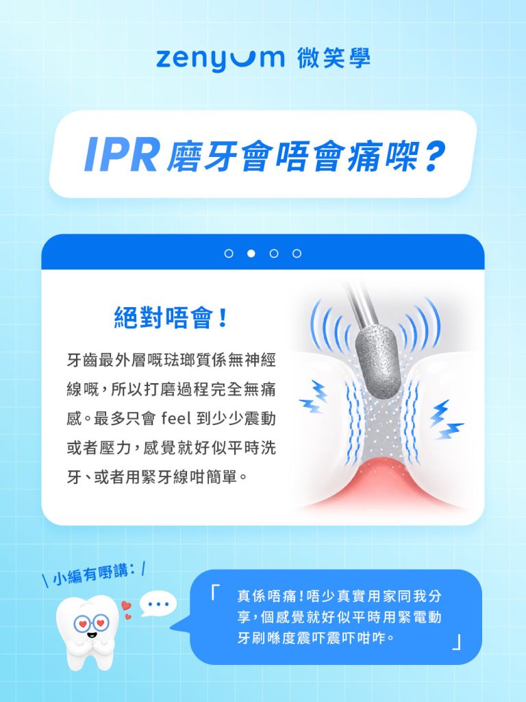 IPR 磨牙會痛嗎?