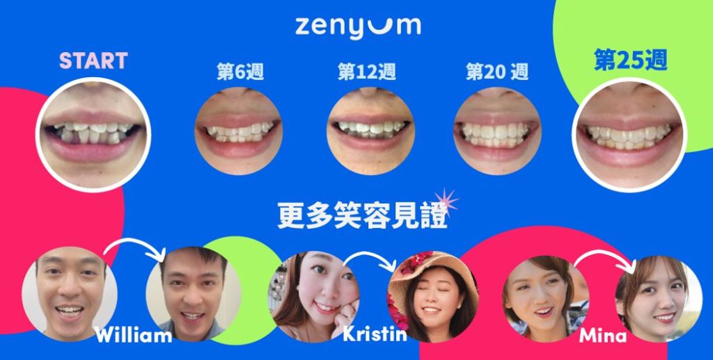 Zenyum 真實用家牙齒變化