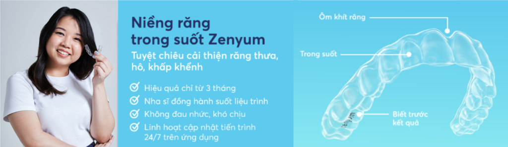 Ưu điểm của Niềng răng trong suốt Zenyum