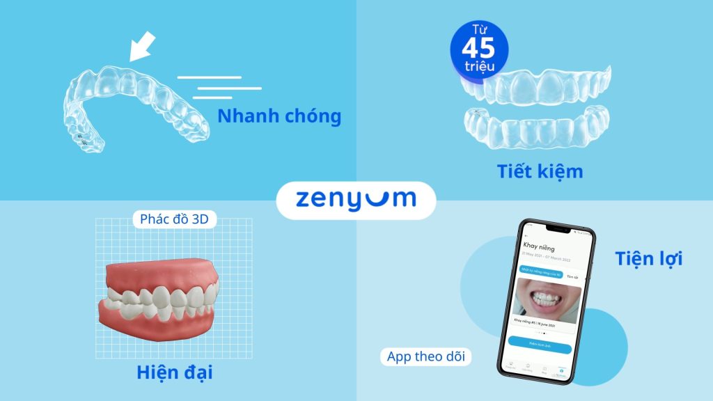 Ưu điểm của niềng răng trong suốt Zenyum