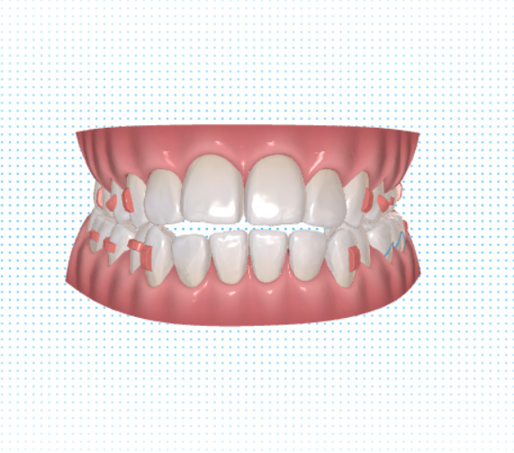 ภาพฟันแบบ 3D