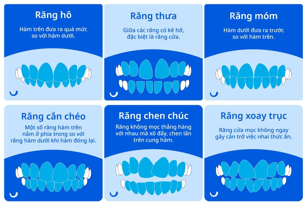 các trường hợp răng cần khắc phục