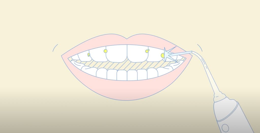 Vệ sinh răng miệng cùng tăm nước