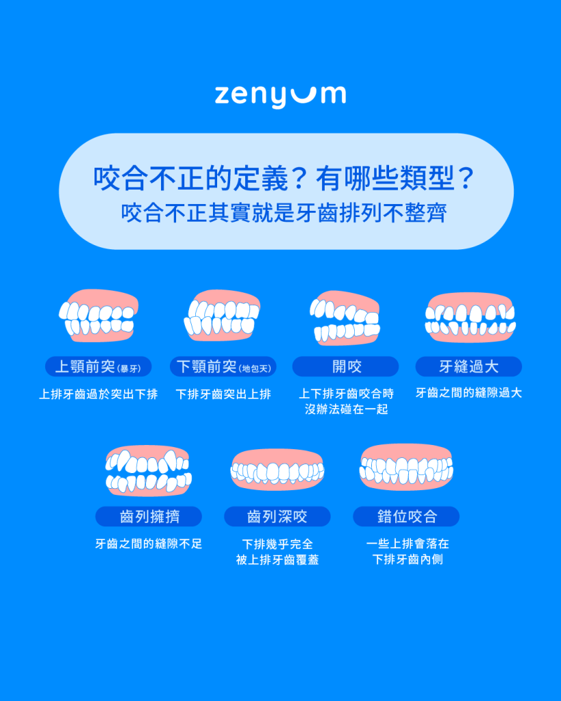 常見牙齒狀況