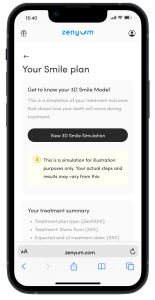 A mobile device displaying a customer's smile plan in the new ZenyumClear™ Smile Journey