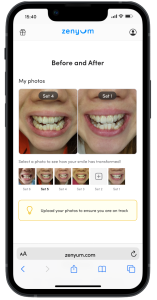 A mobile device showing the appointment scheduling feature in the new ZenyumClear™ Smile Journey