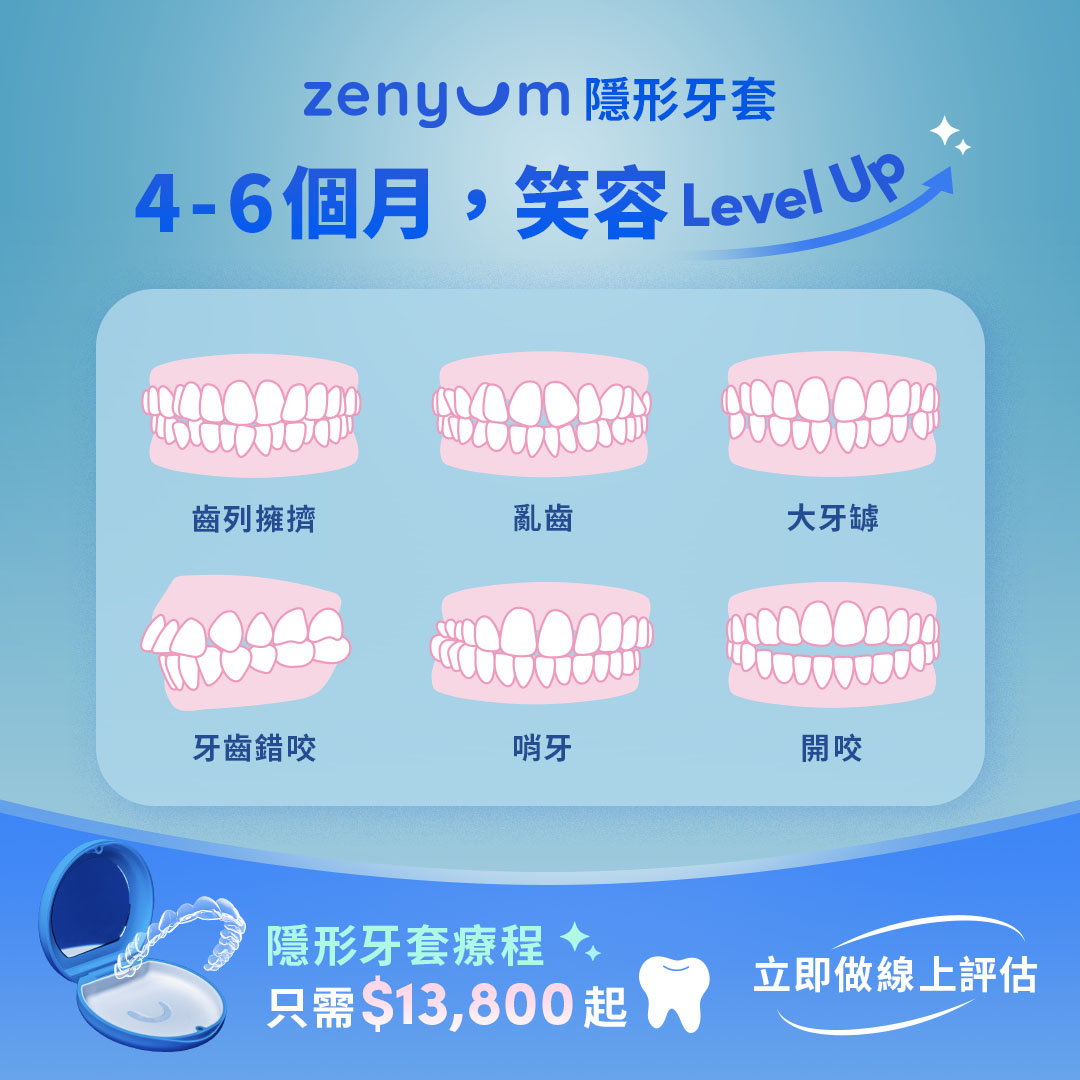 牙齒矯正自我檢測清單，包括牙齒擠擁、牙縫過大、咬合不正及哨牙等問題