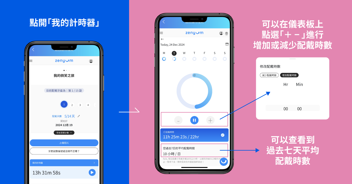 Zenyum 手機 App 遙距監察箍牙進度，預防矯齒失敗