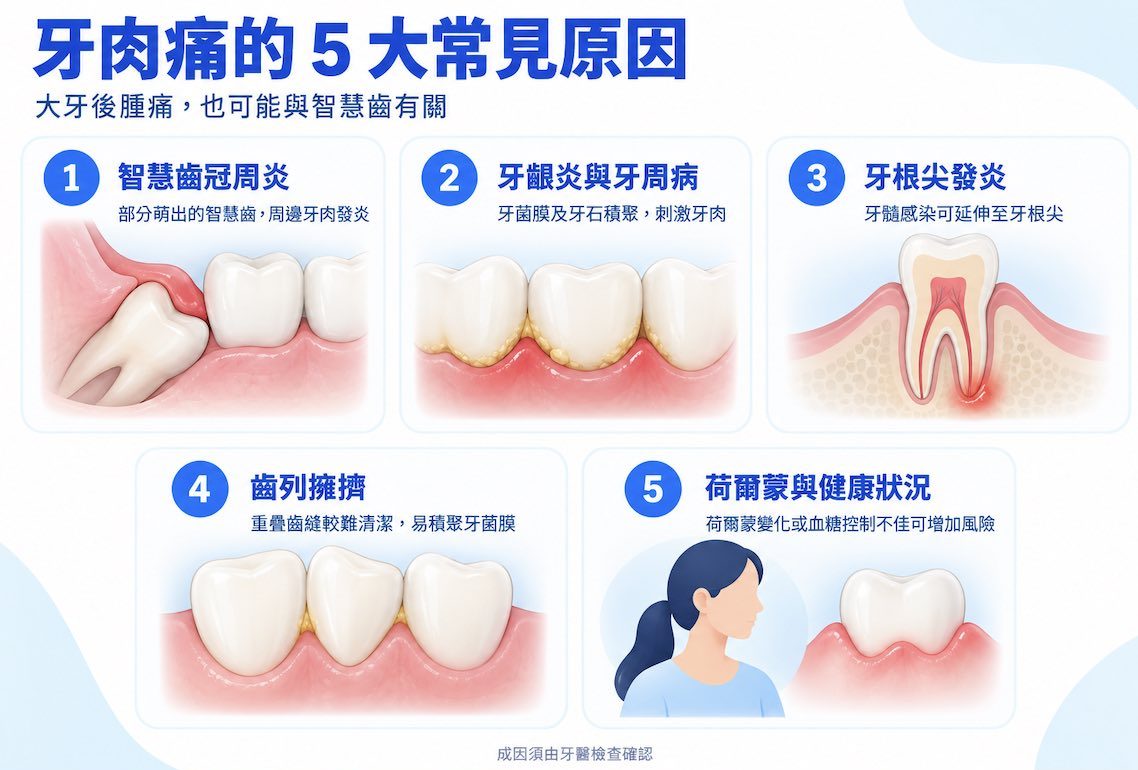 牙肉痛的5大常見原因